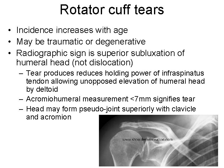 Rotator cuff tears • Incidence increases with age • May be traumatic or degenerative