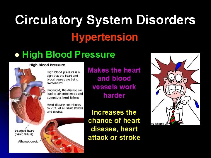 Circulatory System Disorders Hypertension l High Blood Pressure Makes the heart and blood vessels