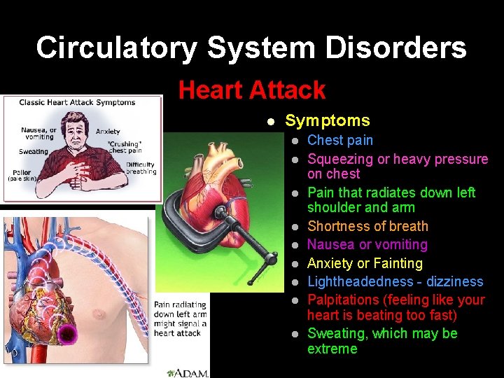 Circulatory System Disorders Heart Attack l Symptoms l l l l l Chest pain