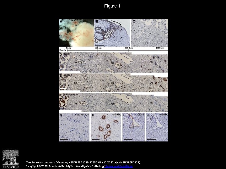 Figure 1 The American Journal of Pathology 2010 1771017 -1030 DOI: (10. 2353/ajpath. 2010.