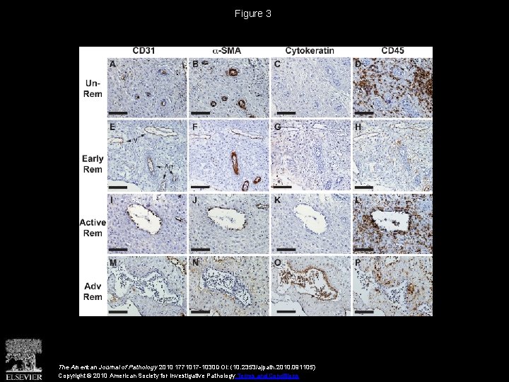 Figure 3 The American Journal of Pathology 2010 1771017 -1030 DOI: (10. 2353/ajpath. 2010.