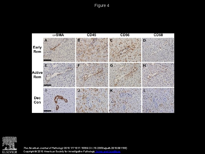 Figure 4 The American Journal of Pathology 2010 1771017 -1030 DOI: (10. 2353/ajpath. 2010.