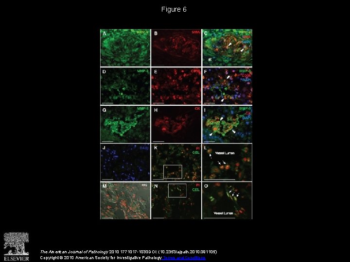 Figure 6 The American Journal of Pathology 2010 1771017 -1030 DOI: (10. 2353/ajpath. 2010.