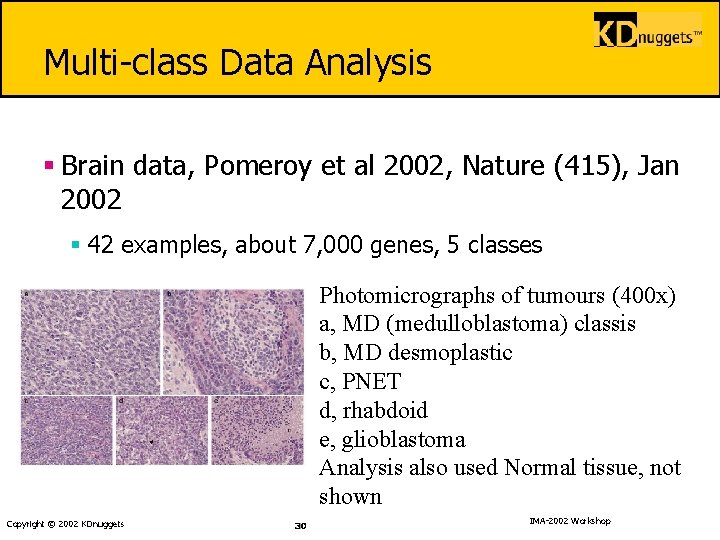 Multi-class Data Analysis § Brain data, Pomeroy et al 2002, Nature (415), Jan 2002