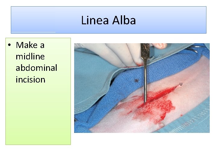 Linea Alba • Make a midline abdominal incision 