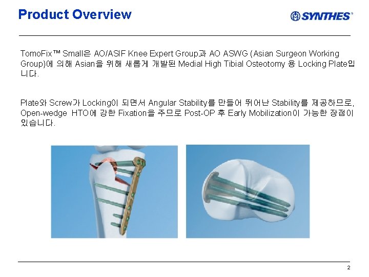 Product Overview Tomo. Fix™ Small은 AO/ASIF Knee Expert Group과 AO ASWG (Asian Surgeon Working
