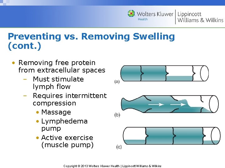Preventing vs. Removing Swelling (cont. ) • Removing free protein from extracellular spaces –