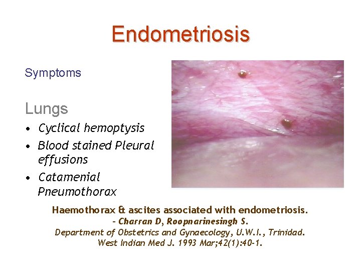 Endometriosis Symptoms Lungs • Cyclical hemoptysis • Blood stained Pleural effusions • Catamenial Pneumothorax