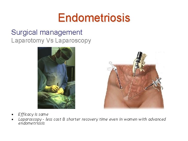 Endometriosis Surgical management Laparotomy Vs Laparoscopy • • Efficacy is same Laparoscopy – less