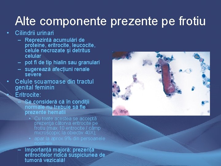 Alte componente prezente pe frotiu • Cilindrii urinari – Reprezintă acumulări de proteine, eritrocite, Alte componente prezente pe frotiu • Cilindrii urinari – Reprezintă acumulări de proteine, eritrocite,