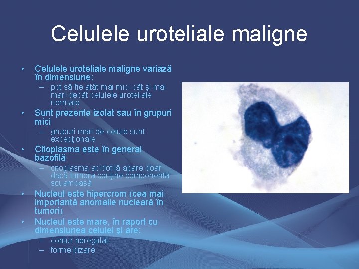 Celulele uroteliale maligne • Celulele uroteliale maligne variază în dimensiune: – pot să fie Celulele uroteliale maligne • Celulele uroteliale maligne variază în dimensiune: – pot să fie