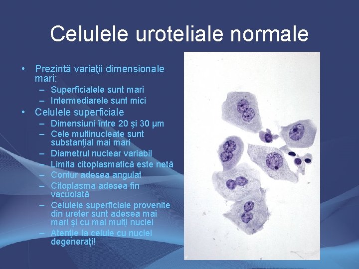 Celulele uroteliale normale • Prezintă variaţii dimensionale mari: – Superficialele sunt mari – Intermediarele Celulele uroteliale normale • Prezintă variaţii dimensionale mari: – Superficialele sunt mari – Intermediarele