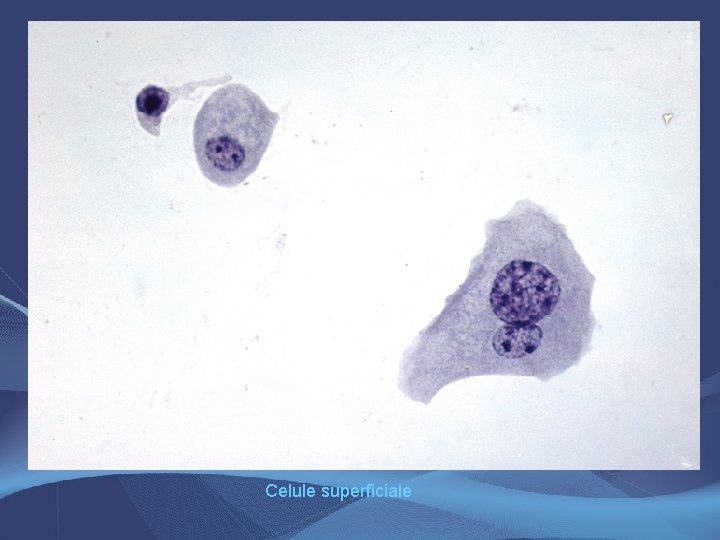 Celule superficiale Celule superficiale