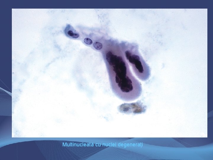 Multinucleată cu nuclei degeneraţi Multinucleată cu nuclei degeneraţi