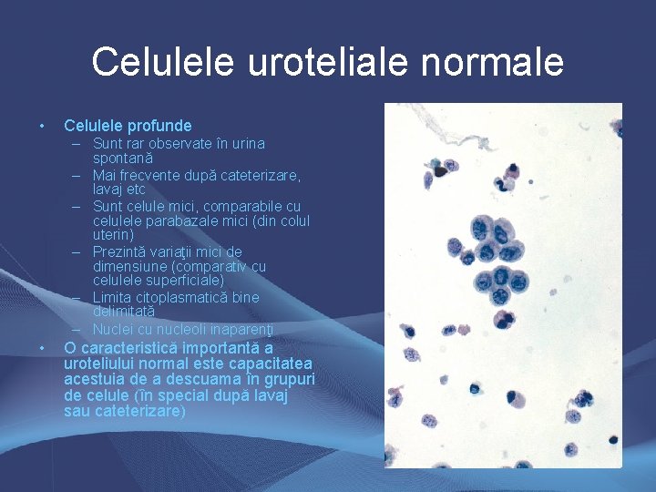 Celulele uroteliale normale • Celulele profunde – Sunt rar observate în urina spontană – Celulele uroteliale normale • Celulele profunde – Sunt rar observate în urina spontană –