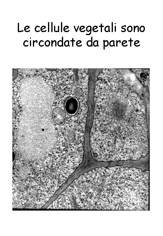 Le cellule vegetali sono circondate da parete 