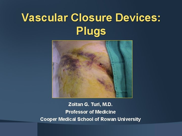 Vascular Closure Devices: Plugs Zoltan G. Turi, M. D. Professor of Medicine Cooper Medical