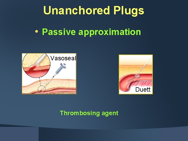 Unanchored Plugs • Passive approximation Vasoseal Duett Thrombosing agent 