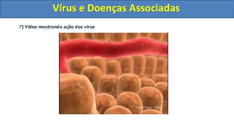 Vírus e Doenças Associadas 7) Vídeo mostrando ação dos vírus 