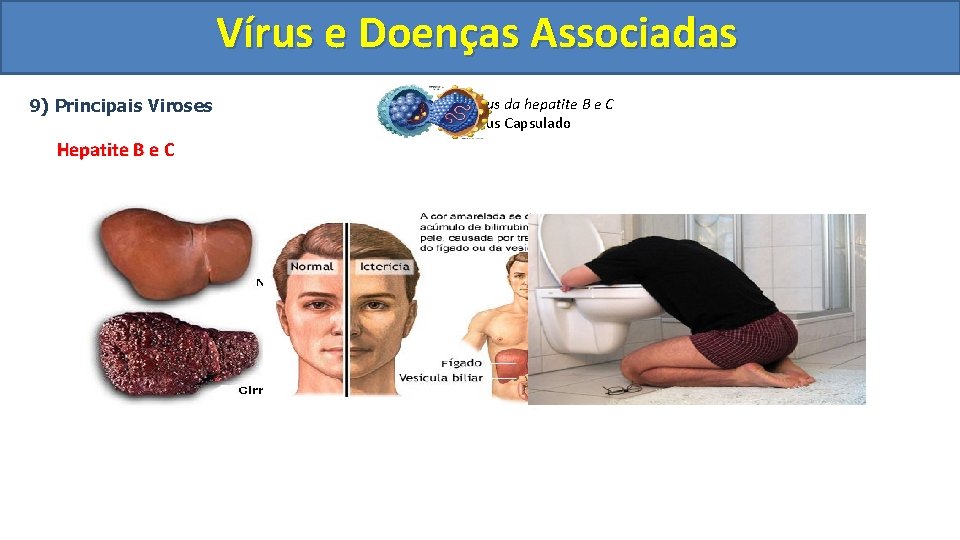 Vírus e Doenças Associadas 9) Principais Viroses Hepatite B e C Vírus da hepatite