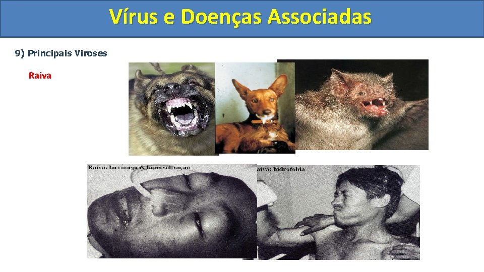 Vírus e Doenças Associadas 9) Principais Viroses Raiva 