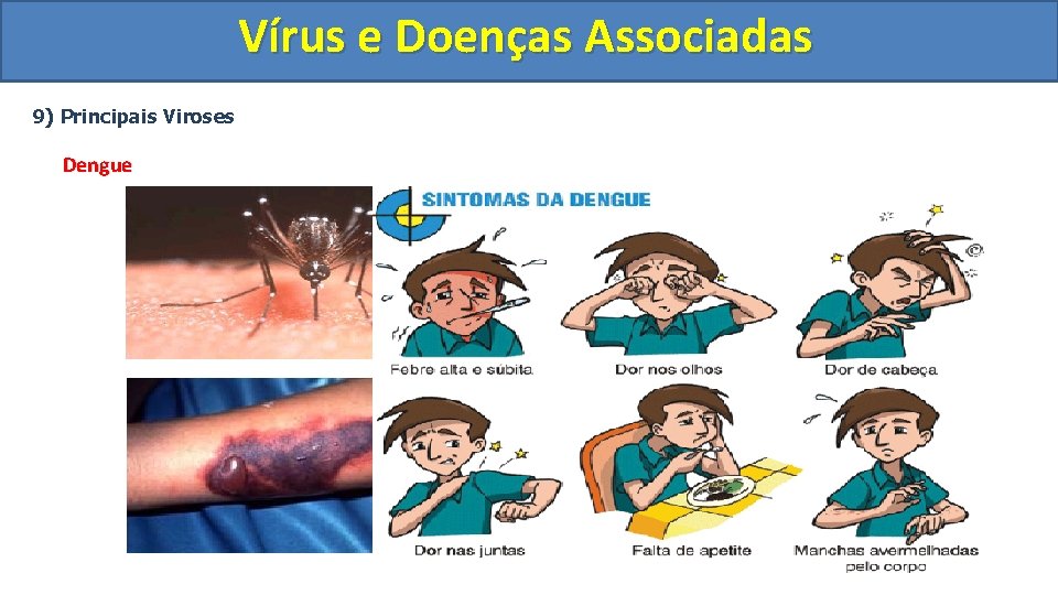 Vírus e Doenças Associadas 9) Principais Viroses Dengue 