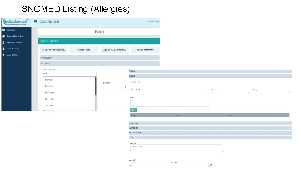 SNOMED Listing (Allergies) 