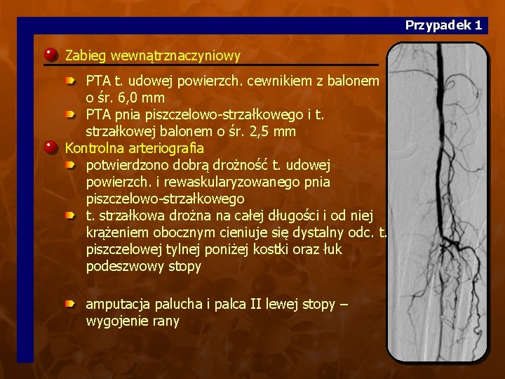 Przypadek 1 Zabieg wewnątrznaczyniowy PTA t. udowej powierzch. cewnikiem z balonem o śr. 6,