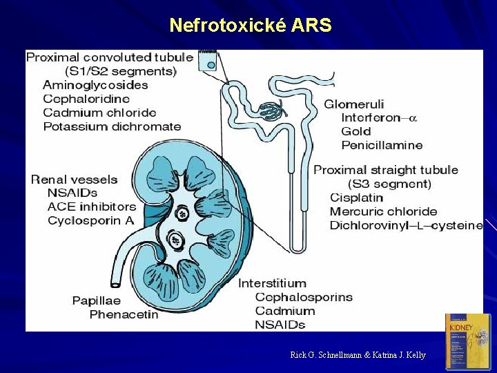 Nefrotoxické ARS Rick G. Schnellmann & Katrina J. Kelly 