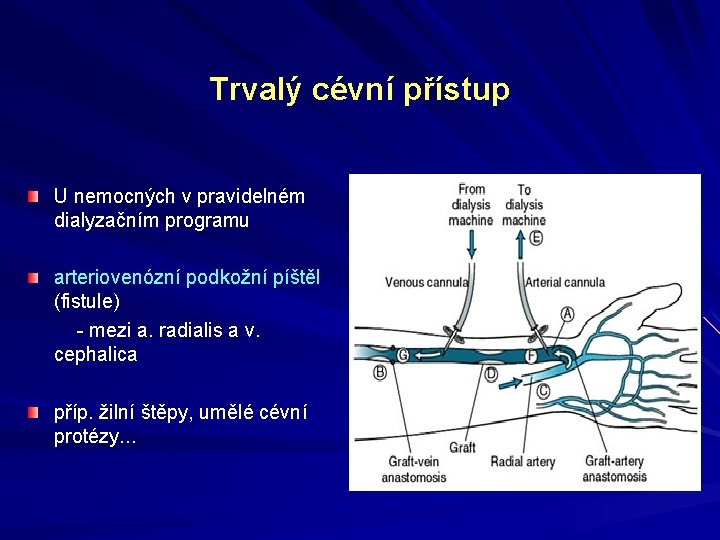 Trvalý cévní přístup U nemocných v pravidelném dialyzačním programu arteriovenózní podkožní píštěl (fistule) -