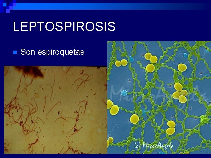LEPTOSPIROSIS n Son espiroquetas 
