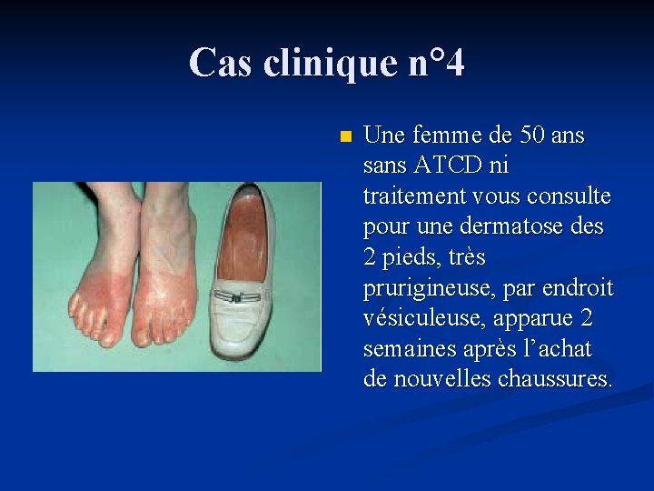 Cas clinique n° 4 n Une femme de 50 ans sans ATCD ni traitement