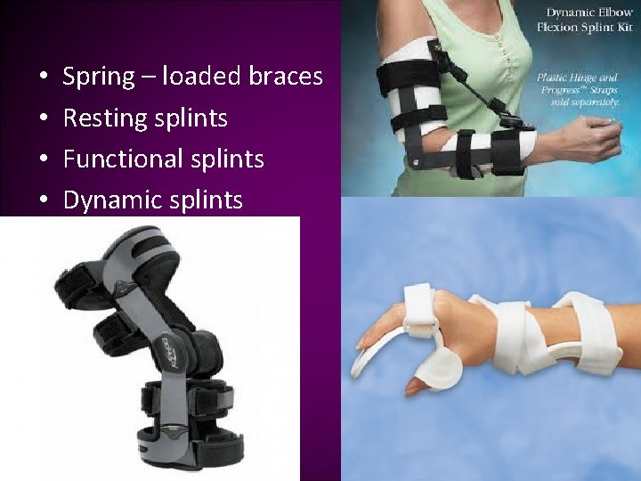  • • Spring – loaded braces Resting splints Functional splints Dynamic splints 