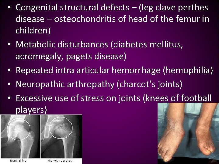  • Congenital structural defects – (leg clave perthes disease – osteochondritis of head