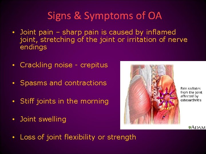 Signs & Symptoms of OA • Joint pain – sharp pain is caused by