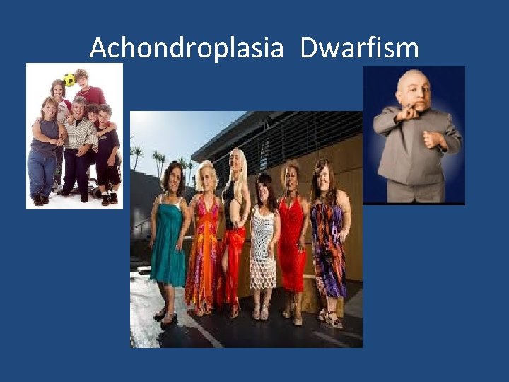 Achondroplasia Dwarfism 