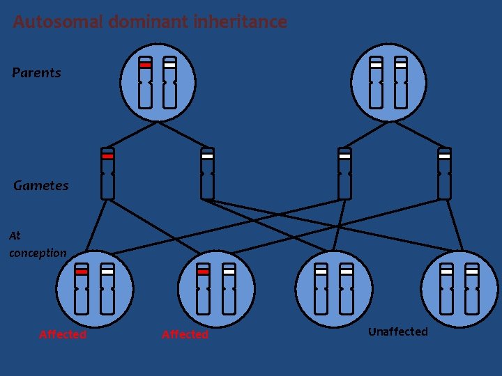 Autosomal dominant inheritance Parents Gametes At conception Affected Unaffected 