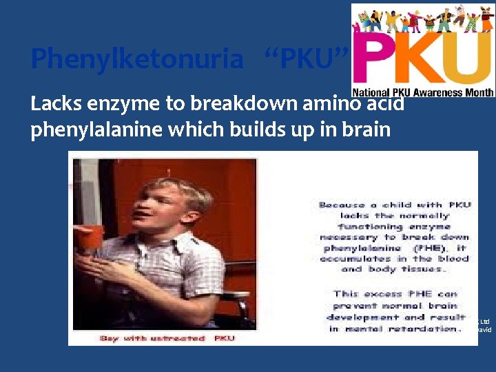 Phenylketonuria “PKU” Lacks enzyme to breakdown amino acid phenylalanine which builds up in brain