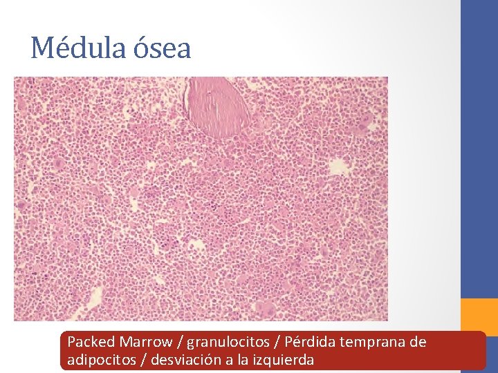 Médula ósea Packed Marrow / granulocitos / Pérdida temprana de adipocitos / desviación a