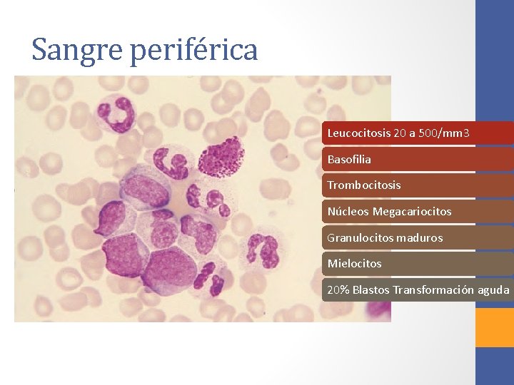 Sangre periférica Leucocitosis 20 a 500/mm 3 Basofilia Trombocitosis Núcleos Megacariocitos Granulocitos maduros Mielocitos