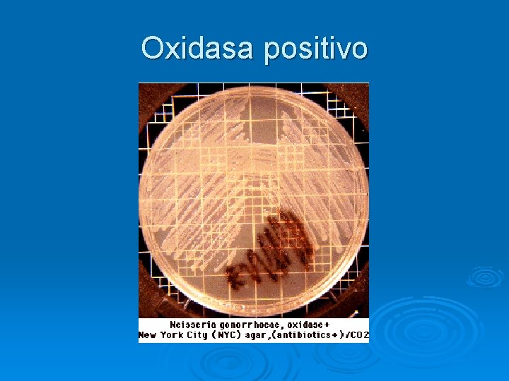 Oxidasa positivo Oxidasa positivo