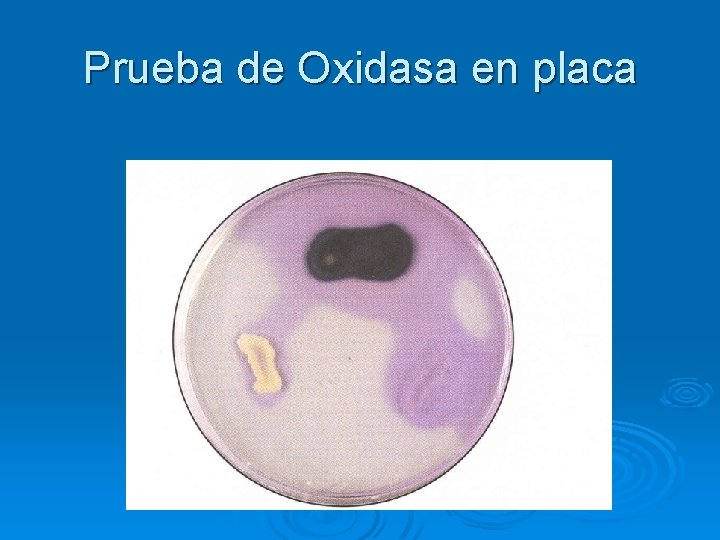 Prueba de Oxidasa en placa Prueba de Oxidasa en placa