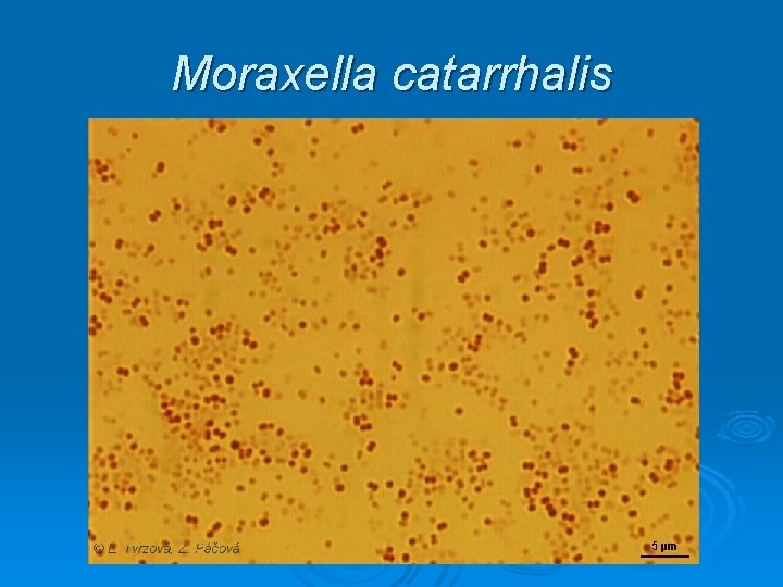 Moraxella catarrhalis Moraxella catarrhalis