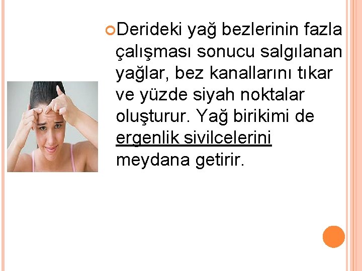  Derideki yağ bezlerinin fazla çalışması sonucu salgılanan yağlar, bez kanallarını tıkar ve yüzde