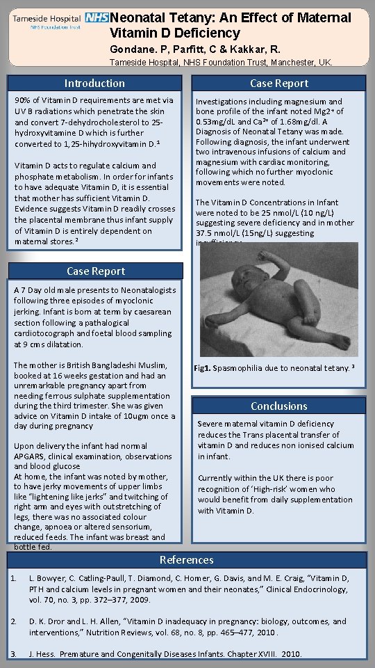 Neonatal Tetany: An Effect of Maternal Vitamin D Deficiency Gondane. P, Parfitt, C &