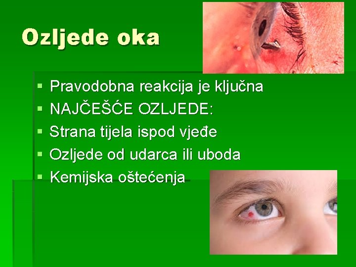 Ozljede oka § § § Pravodobna reakcija je ključna NAJČEŠĆE OZLJEDE: Strana tijela ispod