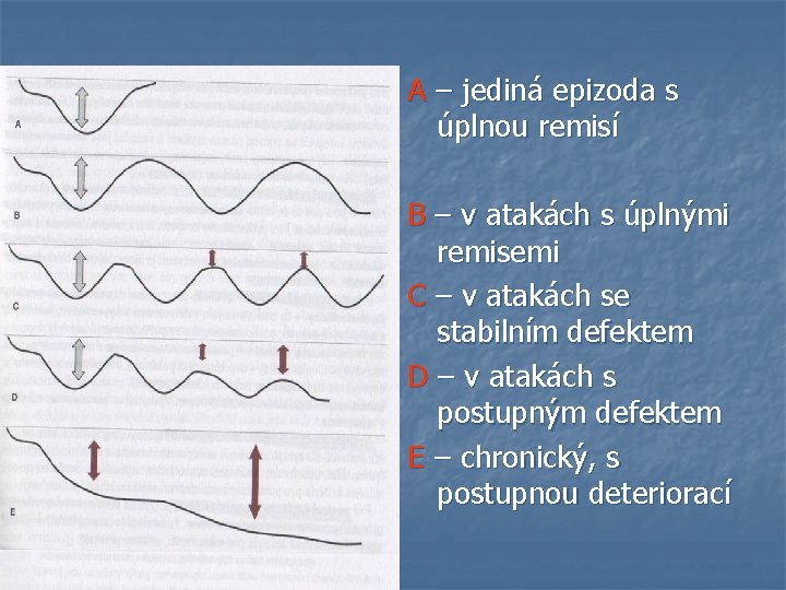 A – jediná epizoda s úplnou remisí B – v atakách s úplnými remisemi