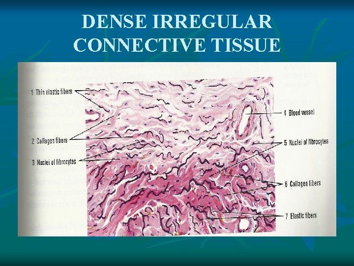 DENSE IRREGULAR CONNECTIVE TISSUE 