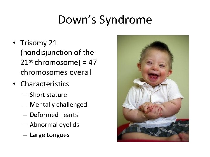 Down’s Syndrome • Trisomy 21 (nondisjunction of the 21 st chromosome) = 47 chromosomes
