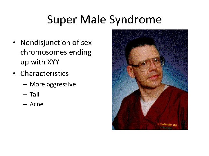 Super Male Syndrome • Nondisjunction of sex chromosomes ending up with XYY • Characteristics